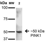 Monoclonal Anti-Ataxin - Biotin antibody produced in mouse clone S76-8, purified immunoglobulin