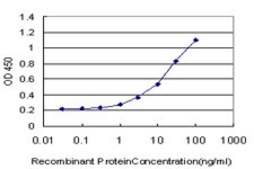 Monoclonal Anti-CNR1 antibody produced in mouse clone 2F9, purified immunoglobulin, buffered aqueous solution