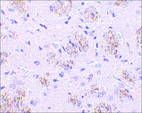 Anti-KLHL1 antibody produced in rabbit affinity isolated antibody, buffered aqueous solution