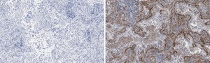 Anti-Integrin αVβ5 Antibody, clone EM09902 , ZooMAb® Rabbit Monoclonal recombinant, expressed in HEK 293 cells