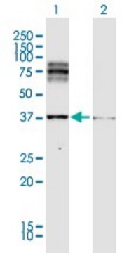 Anti-DCT antibody produced in rabbit purified immunoglobulin, buffered aqueous solution