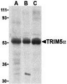 Anti-TRIM5 alpha antibody produced in rabbit affinity isolated antibody