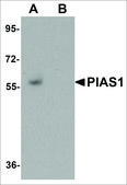 Anti-PIAS1 antibody produced in rabbit affinity isolated antibody, buffered aqueous solution