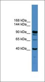 Anti-IFT88 antibody produced in rabbit affinity isolated antibody