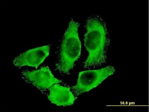 Monoclonal Anti-CKM antibody produced in mouse clone 1E3, purified immunoglobulin, buffered aqueous solution