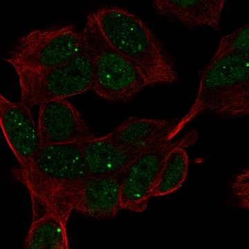 Anti-Hand1 Antibody Produced In Rabbit Prestige Antibodies&#174; Powered by Atlas Antibodies, affinity isolated antibody, buffered aqueous glycerol solution