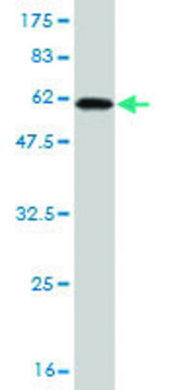 Monoclonal Anti-RLBP1 antibody produced in mouse clone 1H7, purified immunoglobulin, buffered aqueous solution