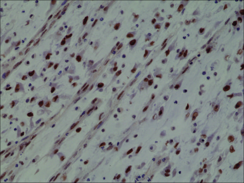 Anti-MyoD1 antibody, Rabbit monoclonal recombinant, expressed in HEK 293 cells, clone RM369, purified immunoglobulin