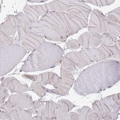 Anti-LPIN2 antibody produced in rabbit Prestige Antibodies® Powered by Atlas Antibodies, affinity isolated antibody, buffered aqueous glycerol solution