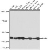Anti-BMP6 Antibody, clone 6N5S9, Rabbit Monoclonal