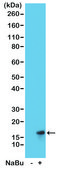 Anti-Acetyl-Histone H3 (Lys27) antibody, Rabbit monoclonal recombinant, expressed in HEK 293 cells, clone RM172, purified immunoglobulin