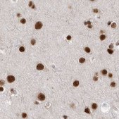 Anti-PPP1R8 antibody produced in rabbit Prestige Antibodies® Powered by Atlas Antibodies, affinity isolated antibody, buffered aqueous glycerol solution, Ab2