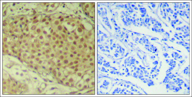 Anti-SMAD2 (Ab-220) antibody produced in rabbit affinity isolated antibody