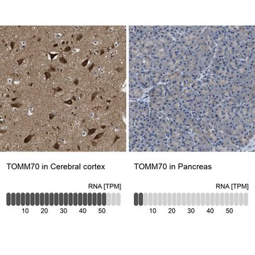 Anti-TOMM70 antibody produced in rabbit Prestige Antibodies&#174; Powered by Atlas Antibodies, affinity isolated antibody, buffered aqueous glycerol solution