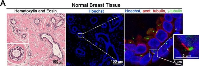 Anti-&#947;-Tubulin antibody, Mouse monoclonal clone GTU-88, purified from hybridoma cell culture