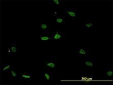 Monoclonal Anti-PSMB8 antibody produced in mouse clone 1B3, purified immunoglobulin, buffered aqueous solution