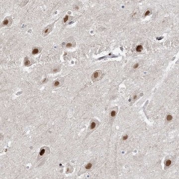 Anti-WAC antibody produced in rabbit Prestige Antibodies&#174; Powered by Atlas Antibodies, affinity isolated antibody, buffered aqueous glycerol solution