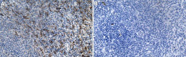 Anti-CD5L Antibody, clone 2D23 ZooMAb&#174; Rabbit Monoclonal recombinant, expressed in HEK 293 cells