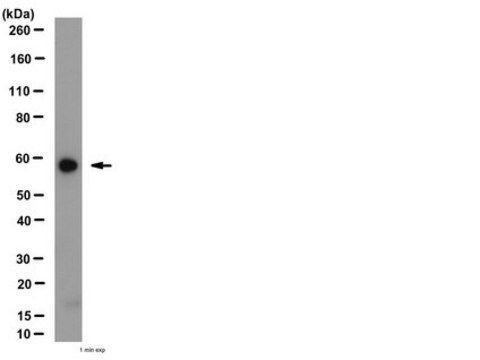 Anti-Angiopoietin-1 Antibody from rabbit