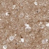 Anti-SORBS1 antibody produced in rabbit Prestige Antibodies® Powered by Atlas Antibodies, affinity isolated antibody, buffered aqueous glycerol solution