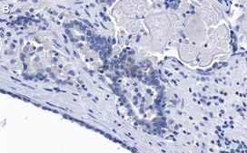 Anti-phospho-eIF-2α-Ser51 Antibody, clone 4N22 ZooMAb® Rabbit Monoclonal recombinant, expressed in HEK 293 cells