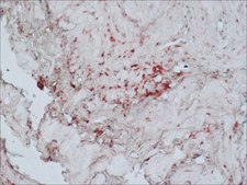 Anti-Histone Deacetylase 5 (HDAC5) (NA-16) antibody produced in rabbit affinity isolated antibody, buffered aqueous solution