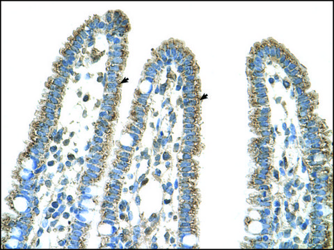 Anti-CPS1 (AB2) antibody produced in rabbit IgG fraction of antiserum