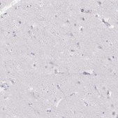 Anti-PRG3 antibody produced in rabbit Prestige Antibodies® Powered by Atlas Antibodies, affinity isolated antibody, buffered aqueous glycerol solution