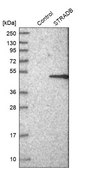 Anti-STRADB antibody produced in rabbit Prestige Antibodies® Powered by Atlas Antibodies, affinity isolated antibody, buffered aqueous glycerol solution