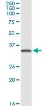 Anti-TNNT1 antibody produced in rabbit purified immunoglobulin, buffered aqueous solution