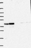 Anti-RNF14 antibody produced in rabbit Prestige Antibodies® Powered by Atlas Antibodies, affinity isolated antibody, buffered aqueous glycerol solution