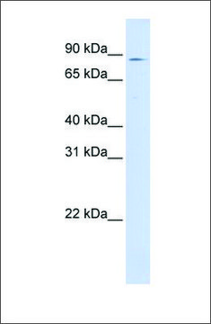 Anti-CPT1A antibody produced in rabbit affinity isolated antibody, lyophilized powder