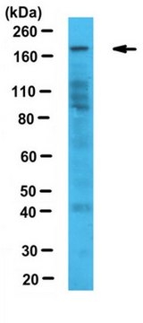 Anti-JARID1C Antibody from rabbit