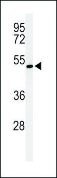 ANTI-ZDHHC9(C-TERMINAL) antibody produced in rabbit affinity isolated antibody, buffered aqueous solution