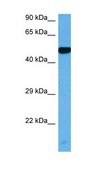 Anti-MyC (AB1) antibody produced in rabbit affinity isolated antibody