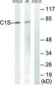 Anti-C1S, C-Terminal antibody produced in rabbit affinity isolated antibody