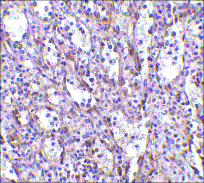 Anti-STIM1 antibody produced in rabbit affinity isolated antibody, buffered aqueous solution