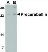Anti-Precerebellin (ab2) antibody produced in rabbit affinity isolated antibody, buffered aqueous solution