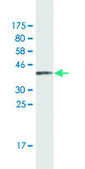 Monoclonal Anti-MAGEA3 antibody produced in mouse clone 4D9, purified immunoglobulin, buffered aqueous solution