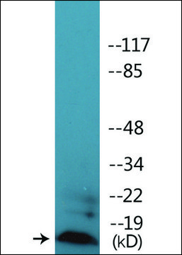 Anti-phospho-Synuclein (pSer129) antibody produced in rabbit affinity isolated antibody