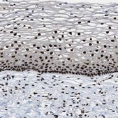 Anti-NUMA1 antibody produced in rabbit Prestige Antibodies® Powered by Atlas Antibodies, affinity isolated antibody, buffered aqueous glycerol solution, Ab2