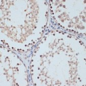 Anti-Phospho-STAT1-S727 antibody produced in rabbit