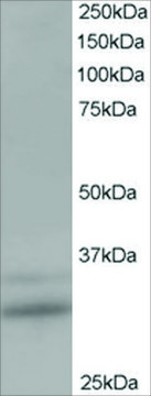 Anti-TIP30/CC3 antibody produced in goat affinity isolated antibody, buffered aqueous solution