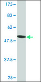 Monoclonal Anti-RPS5 antibody produced in mouse clone 3A5, purified immunoglobulin, buffered aqueous solution