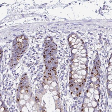 Anti-NLRP8 antibody produced in rabbit Prestige Antibodies&#174; Powered by Atlas Antibodies, affinity isolated antibody, buffered aqueous glycerol solution