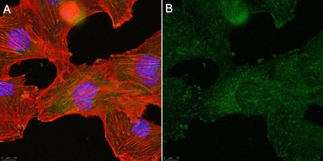 Anti-&#945;-Parvin Antibody, clone 1D4