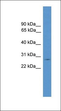 Anti-CLRN1 antibody produced in rabbit affinity isolated antibody