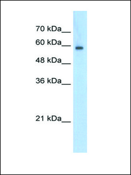 Anti-EIF4G3 antibody produced in rabbit affinity isolated antibody