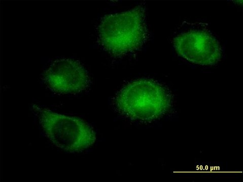 Anti-RABGAP1 antibody produced in mouse purified immunoglobulin, buffered aqueous solution