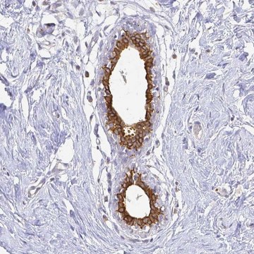 Anti-CIB1 antibody produced in rabbit Prestige Antibodies&#174; Powered by Atlas Antibodies, affinity isolated antibody